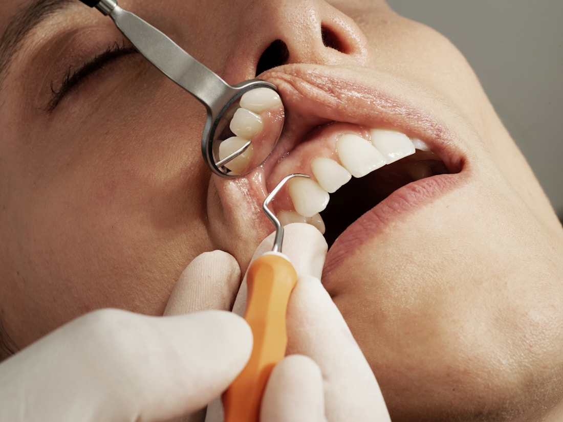 A dentist gently examining a patient at Ever Dental Clinic